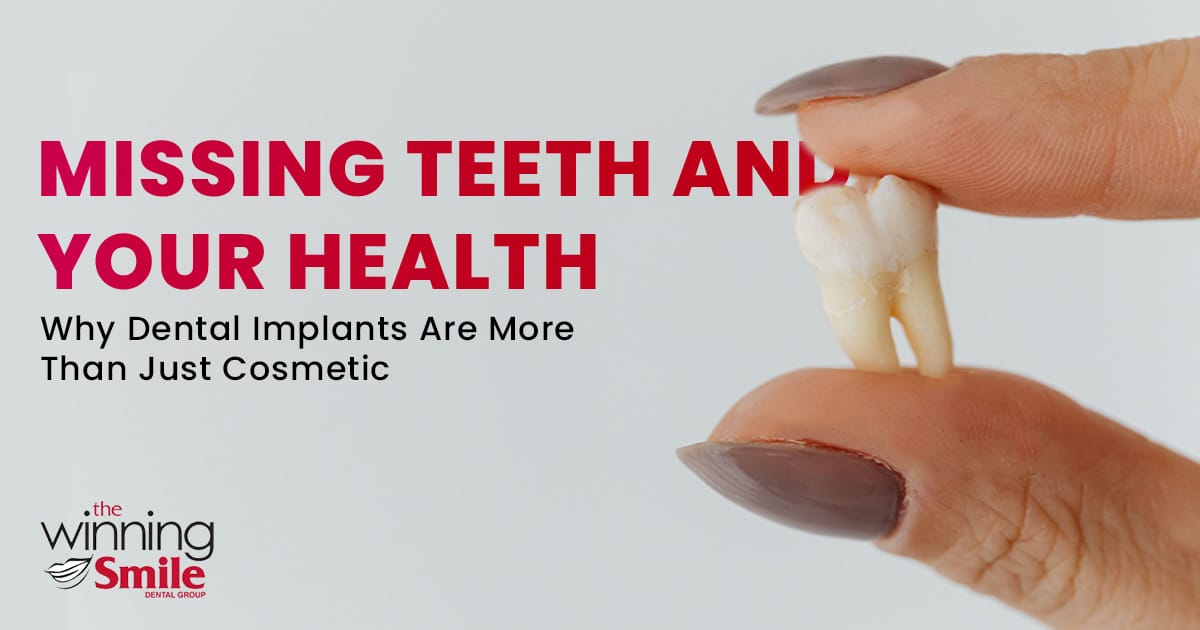 Missing tooth held between fingers with text explaining how dental implants support health beyond cosmetic benefits.